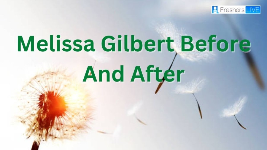 Melissa Gilbert Before And After, Melissa Gilberts Plastic Surgery, Age, Net Worth, Biography, And More